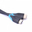 Кабель HDMI 1.5м Vention VAA-B01-L150 круглый черный5